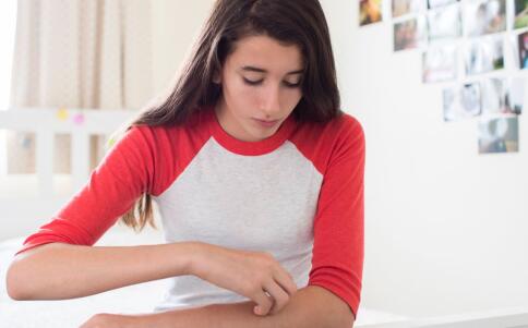 服用避孕药祛痘需谨慎！