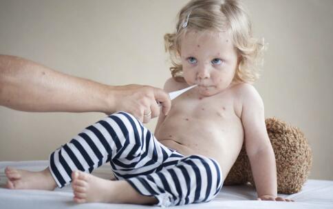 假如没有斑点，我会更自傲!