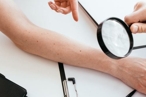 男人右臂膀最吉祥的痣