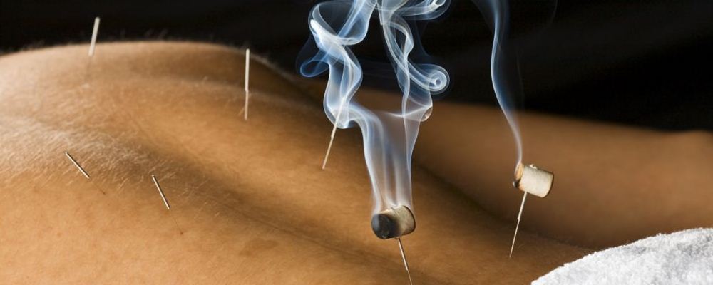 肩周炎的针灸医治办法