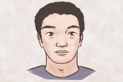 抬头纹有痣好吗 是红痣会怎么