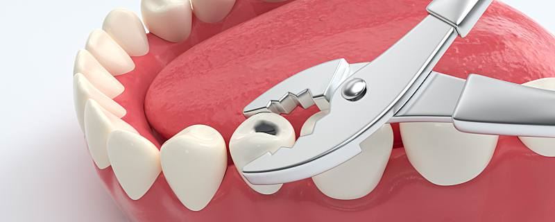 梦见牙齿掉了一颗下牙是什么意思 梦见牙齿掉了一颗下牙代表什么征兆