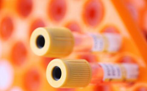 少精做哪些查看 10种症状男性有必要体检