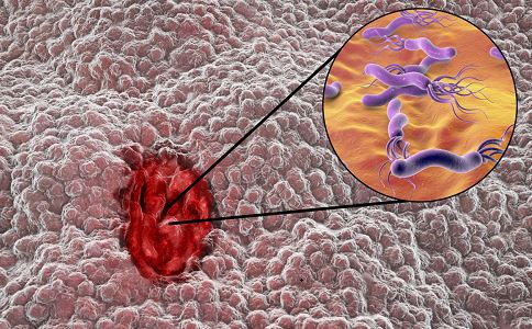 防备胃癌的饮食