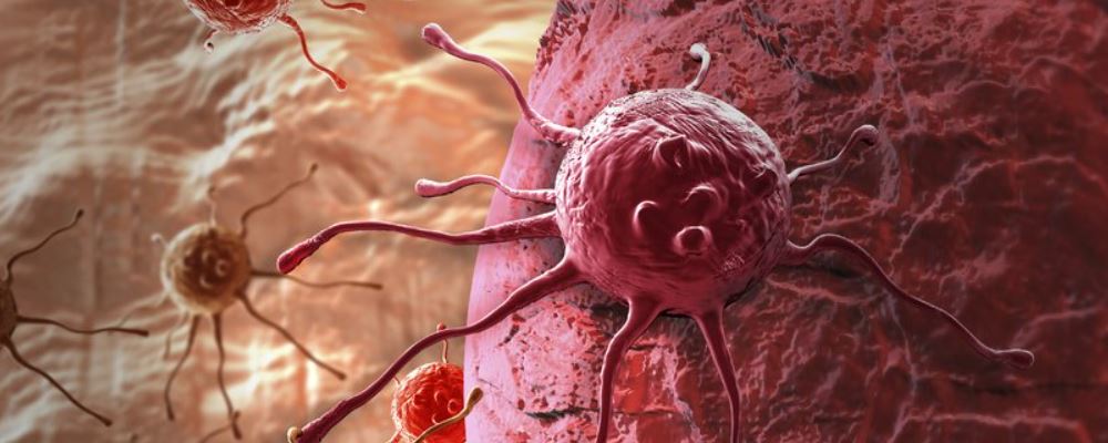 吃什么最简单得癌症