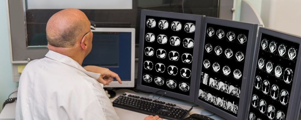 吃什么最简单得癌症