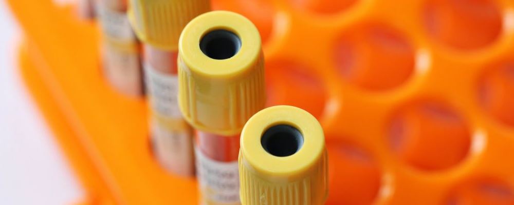 抗癌中药深绿柏