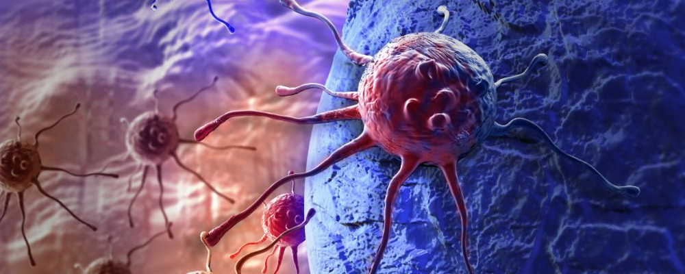 吃什么食物防癌抗癌最好