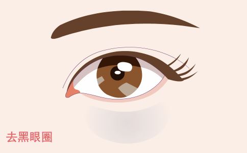 祛斑 激光祛斑的原理