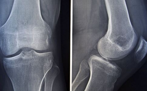 防备颈椎病有什么留意点