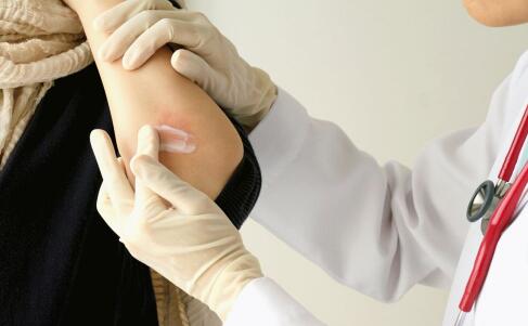 吸烟易患皮肤癌