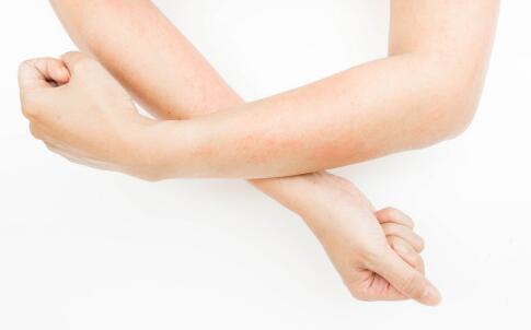 吸烟易患皮肤癌