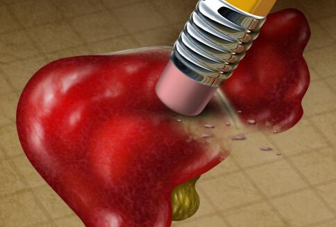 肝血管瘤患者的饮食