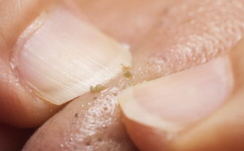 含有铁质的食物