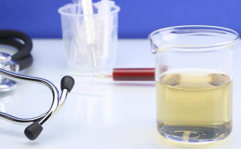 体检前能喝水吗