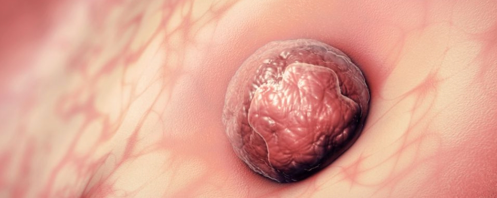 13天卵泡巨细正常规模 做阴超怎样看出卵子现已排了