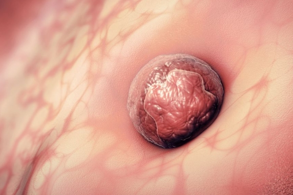 囊胚移植后不着床能存活几天 移植囊胚第9天测灰印图意味着什么