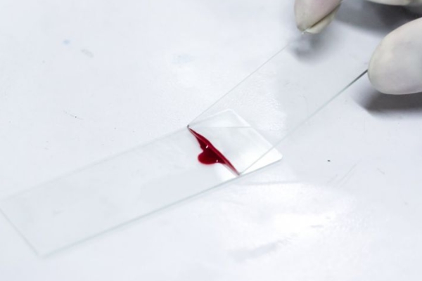 生儿子显怀仍是女孩显怀？显怀迟早和男女有联系吗