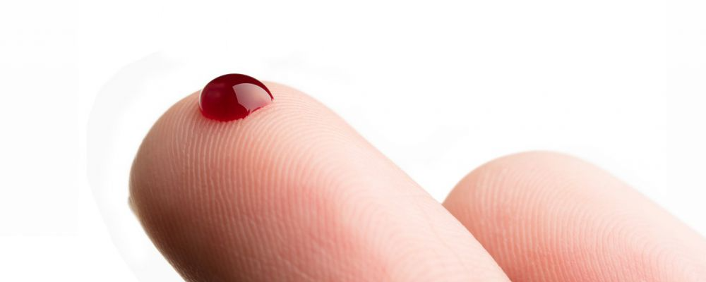 血脂降不下来有4个原因！科学做好这几点，助你轻松下降血脂！