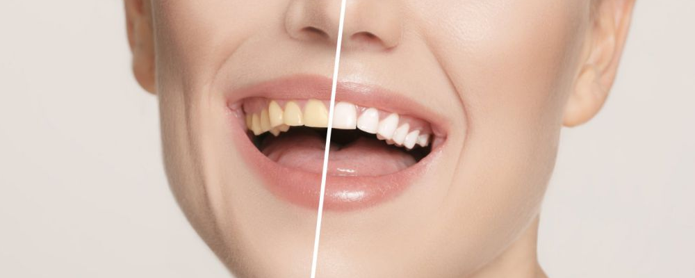 南昌市缺牙做固定桥的口腔医院：附2026年价目表