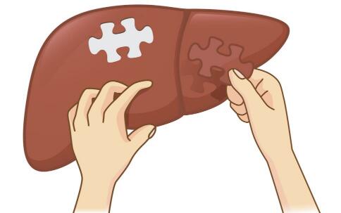 脂肪肝患者宵夜请少吃