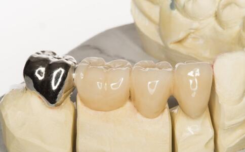 龋齿会不会遗传 怎样防备