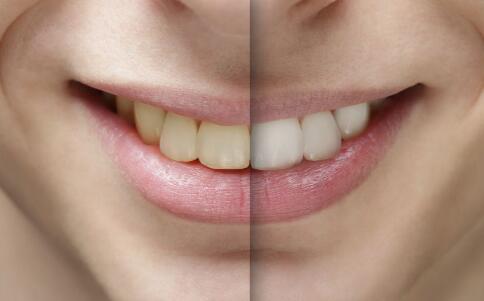 口腔溃疡吃什么生果