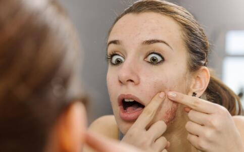 用米饭能够去黑头吗 去黑头的办法有哪些