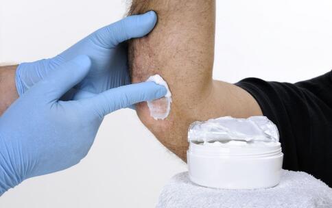 长斑点和内分泌真的有联系吗