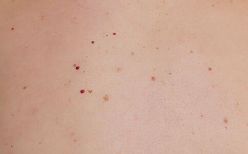 淘米水是护肤“良品”,能防备瘙痒