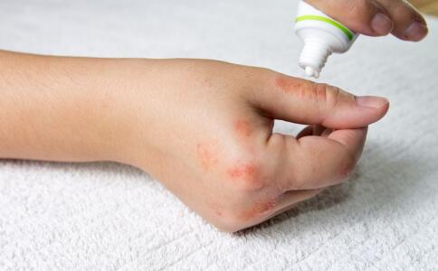 怎么防备秋季枯燥皮肤瘙痒