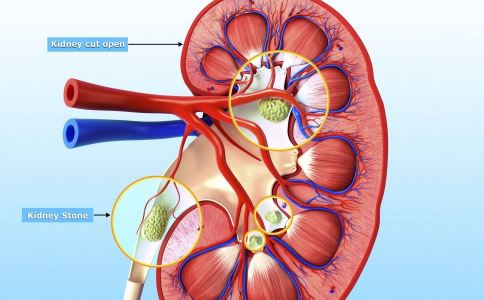 尿毒症晚期怎么治
