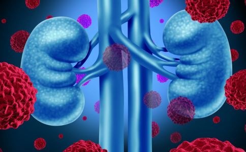 多喝绿茶和咖啡防肾癌有奇效