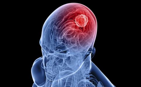 防备脑出血的几种食疗方