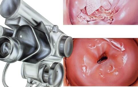 抽血化验前的留意事项