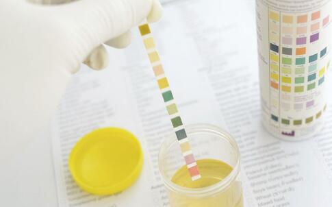 很想知道体检前喝水会影响成果吗