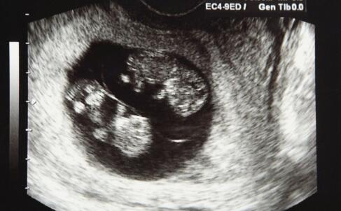 人流前为什么要体检