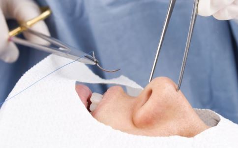 科技美唇三大办法 打造完美双唇